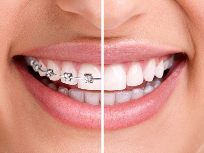 Dr Hebert Guillén_ Ortodoncia & Armonizacion Bucofacial
