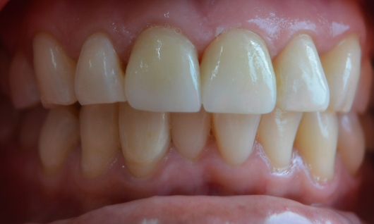 Dr. Rigoberto Cabrera Sánchez, Dentista - Odontólogo - Imagen 1