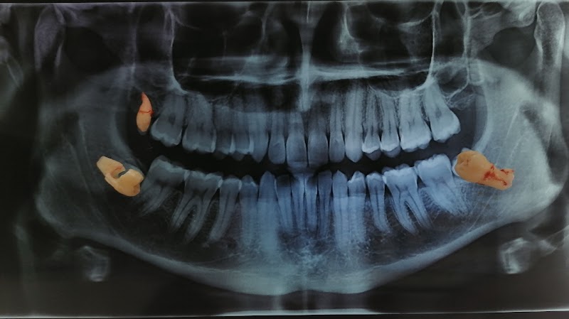 Dental TX